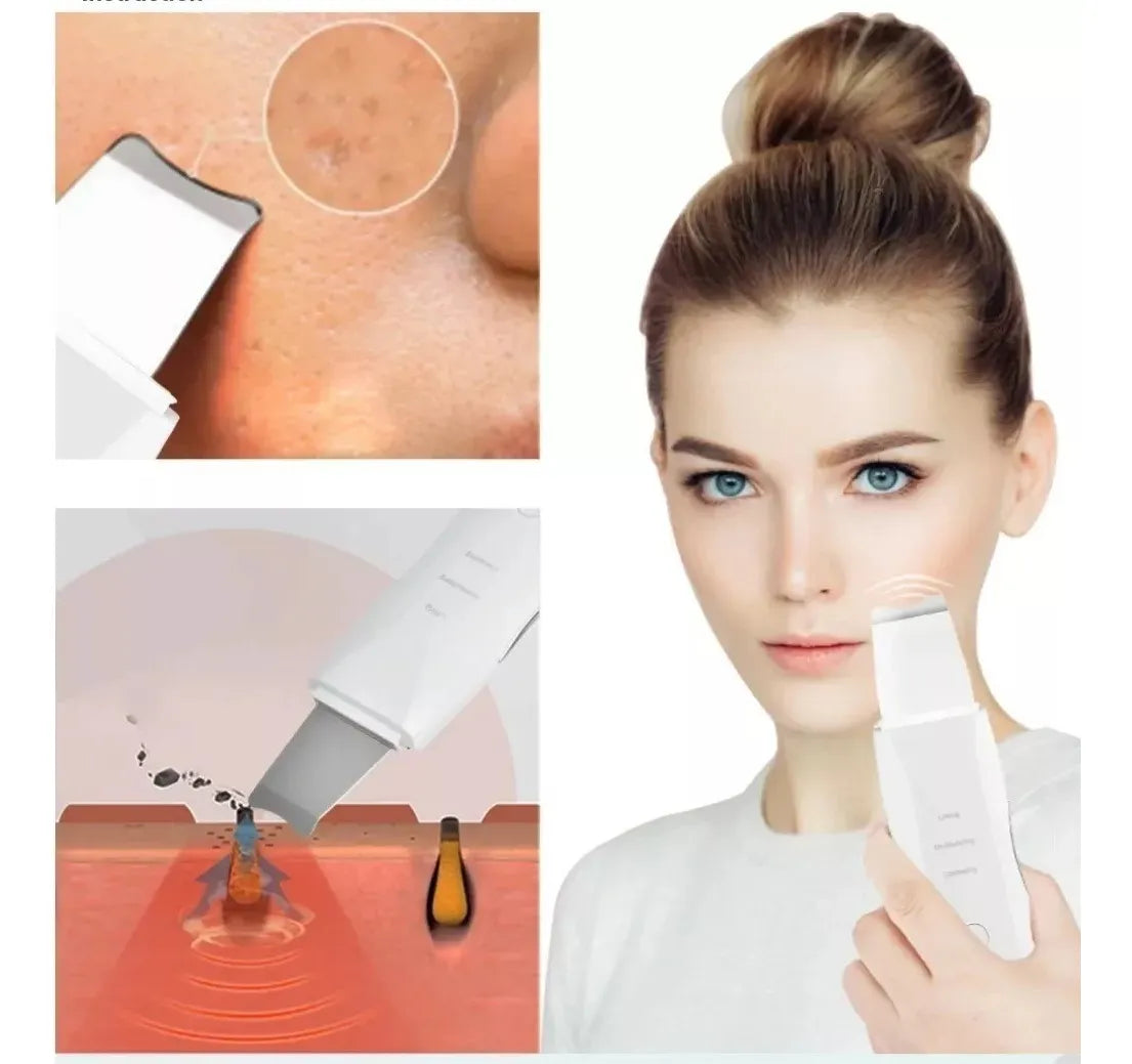 Espatula Facial Ultrasonica Exfoliante